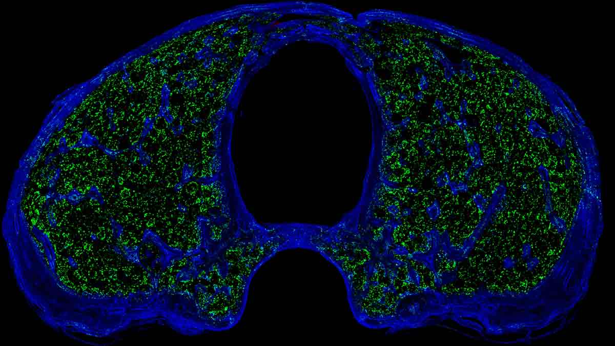 Scientists discover new 'immune hubs' in skull ...
