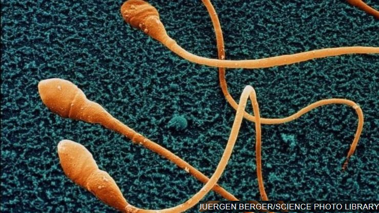 How to increase sperm count,Foods to increase sperm count,Best medicine for low sperm count,ബീജം കൂട്ടാൻ ഈ മാർഗങ്ങൾ, പുരുഷന്മാരിലെ ലൈംഗികാരോഗ്യം