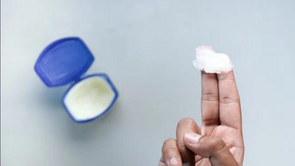 Petroleum Jelly for Dry Skin in Summer: Is It a ...