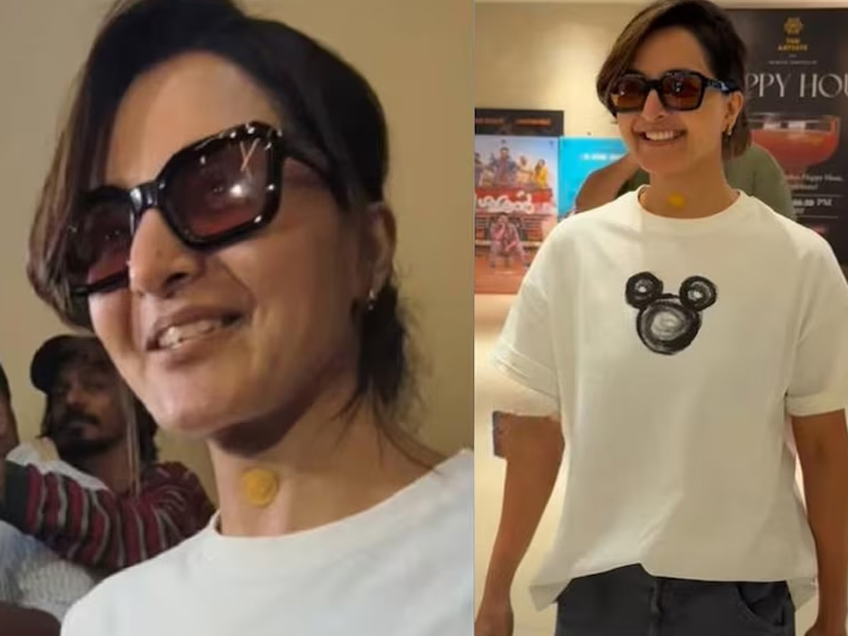Manju Warrier, neck patch, Anomie, Manju Warrier news, മഞ്ജു വാര്യർ, കഴുത്തിലെ പാച്ച്, അനോമി, മഞ്ജു വാര്യർ വാർത്തകൾ