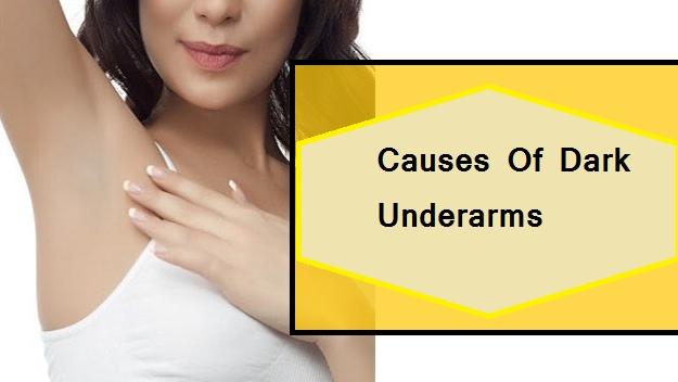 Causes Of Dark Underarms 5   1597209496 89 