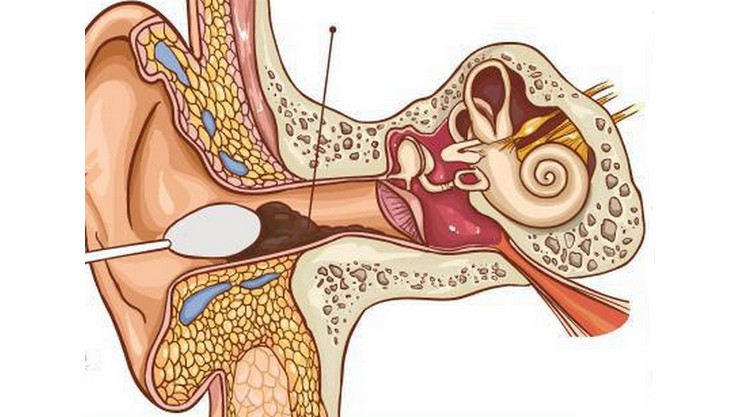 Ear cleaning