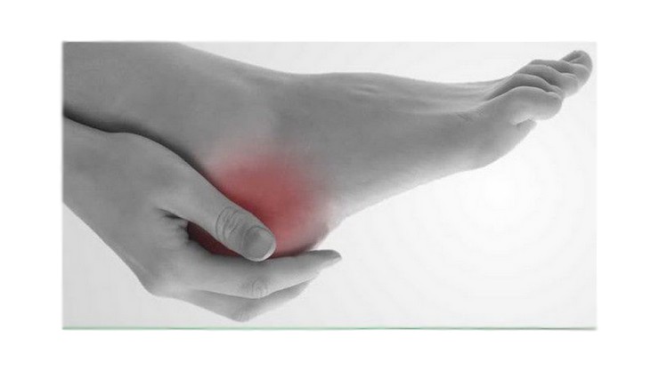 Heel pain