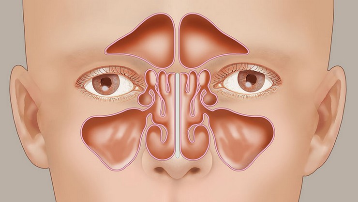 Sinus problem