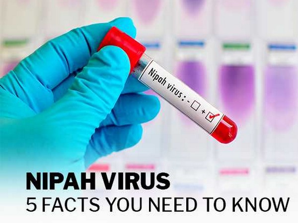 nipah virus