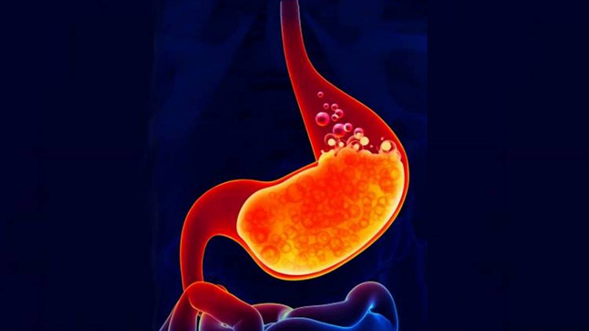 Acidity, అసిడిటీ తగ్గించుకోవడానికి చిట్కాలు