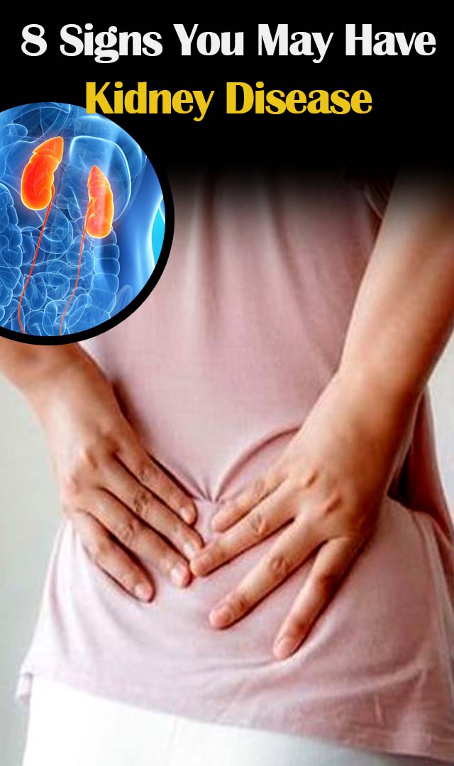 8 Signs You May Have Kidney Disease