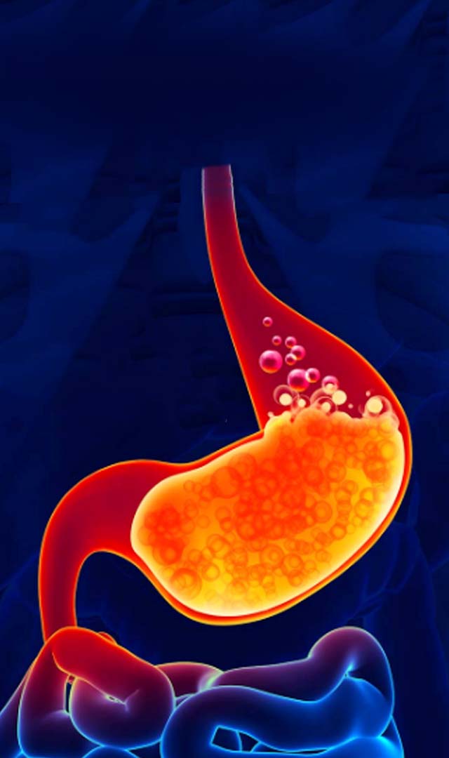 8 Foods to avoid for acidity