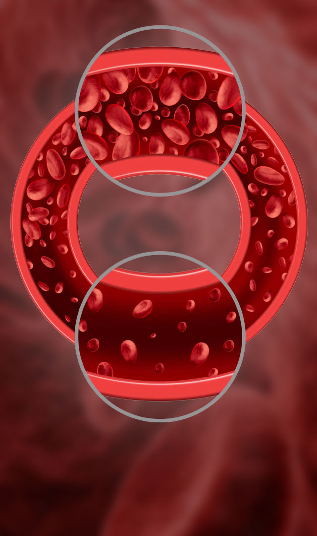 How to increase hemoglobin?