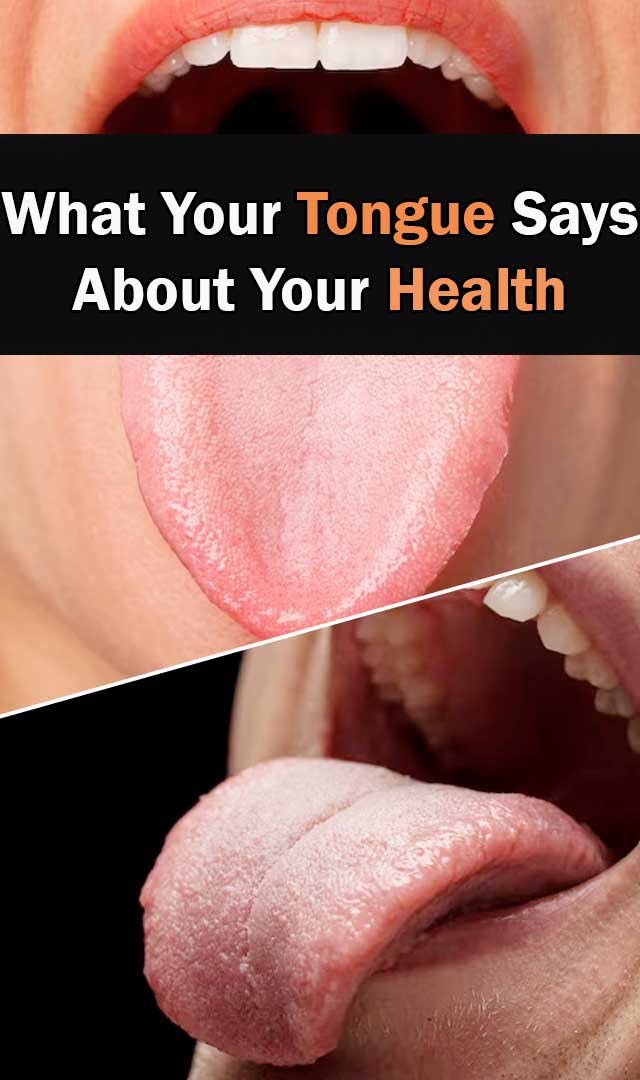 What your tongue says about your health