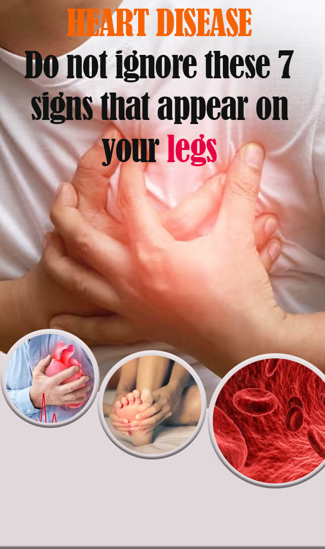 Heart disease symptoms: Do not ignore THESE 7 signs that appear on your legs