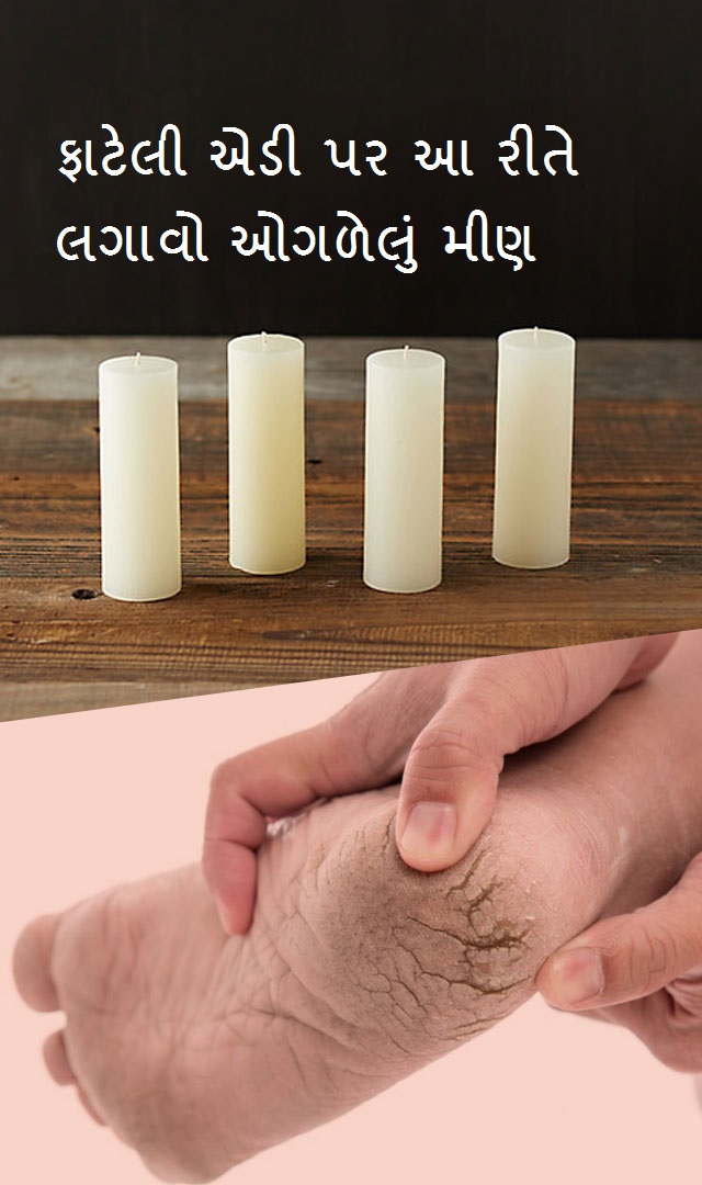 cracked heels-   ફાટેલી એડી પર આ રીતે લગાવો મીણબત્તી