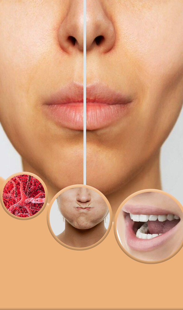 તમારા બેસી ગયેલા ગાલને ફુલાવવા માટે  કરો આ  5 કસરત