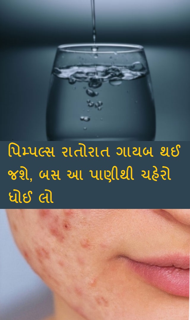 પિમ્પલ્સ રાતોરાત ગાયબ થઈ જશે, બસ આ પાણીથી ચહેરો ધોઈ લો