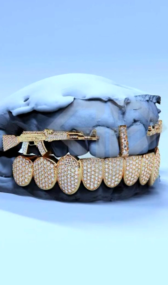 25 लाख की बत्तीसी, दातों में जड़े हैं हीरो