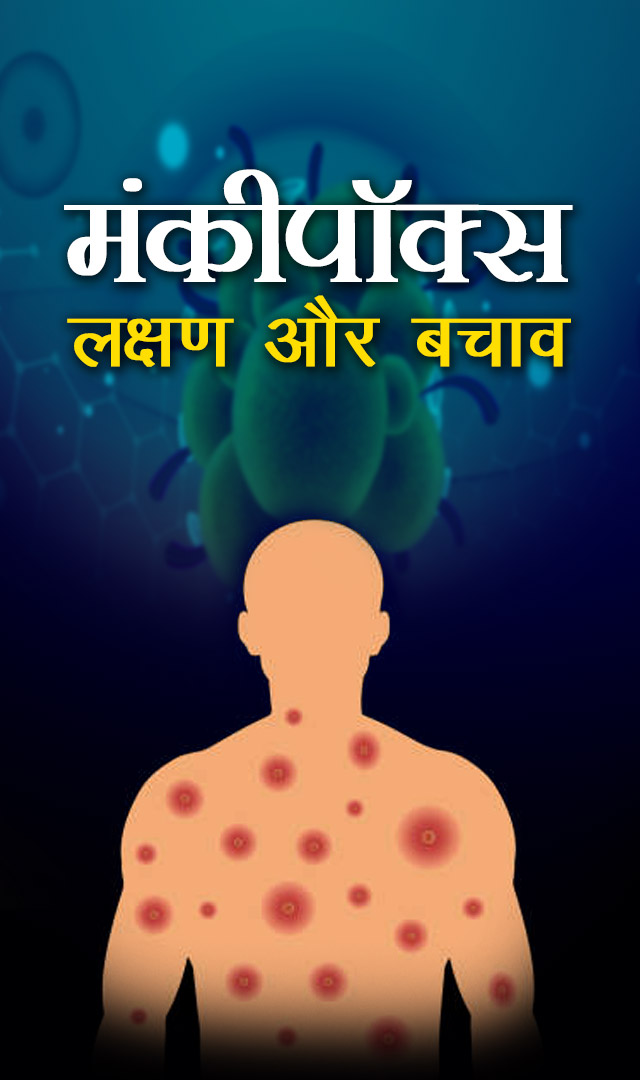 मंकीपॉक्स, लक्षण और बचाव के उपाय। Monkeypox