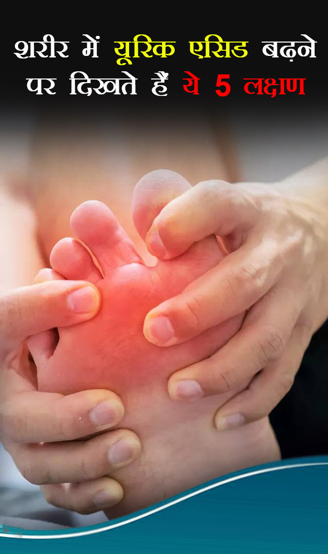 शरीर में यूरिक एसिड बढ़ने पर दिखते हैं ये 5 लक्षण