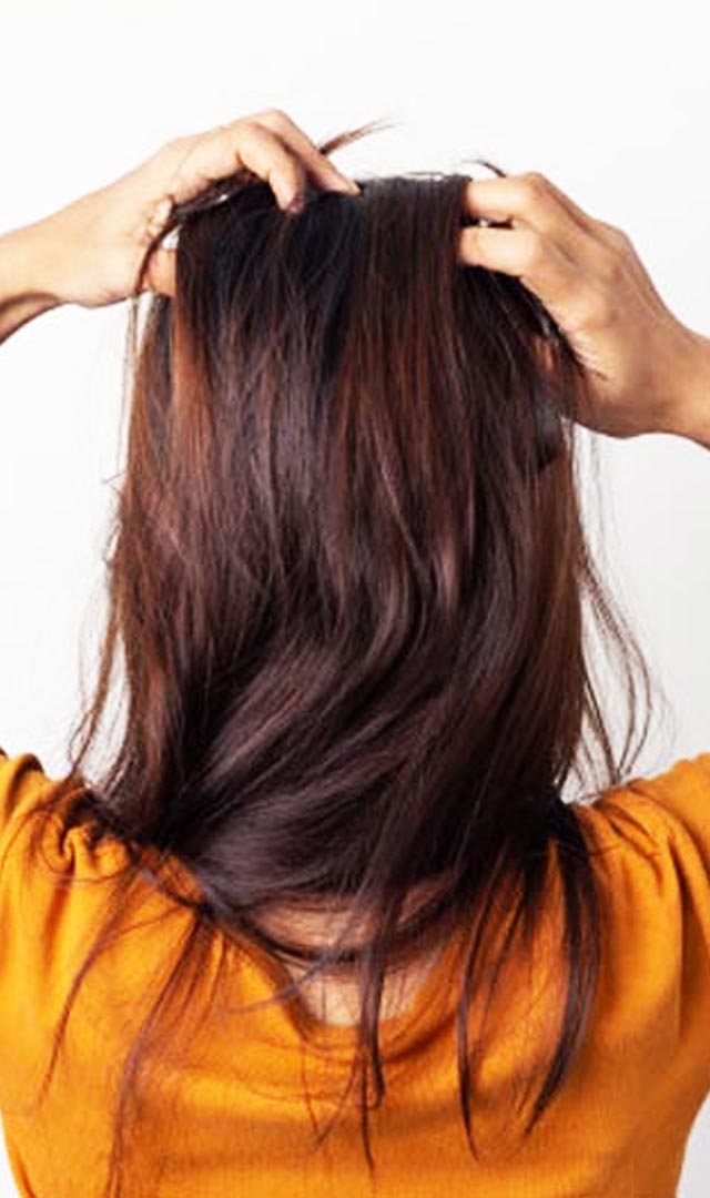 सिर में खुजली से राहत के लिए 7 टिप्स