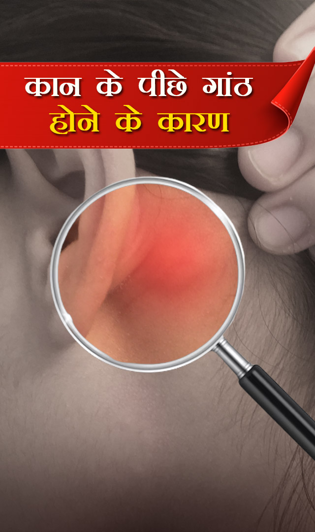 कान के पीछे गांठ होने के कारण