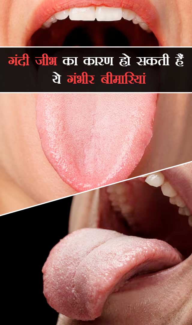 गंदी जीभ का कारण हो सकती हैं ये गंभीर बीमारियां
