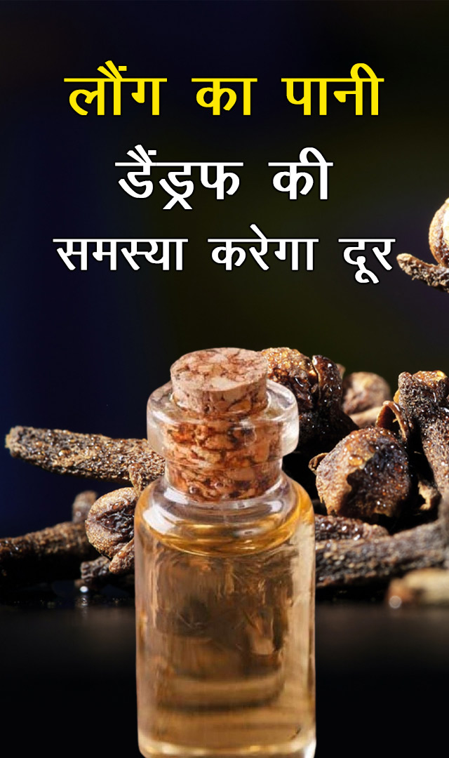 लौंग का पानी डैंड्रफ की समस्या करेगा दूर