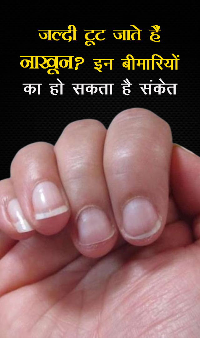 जल्दी टूट जाते हैं नाखून? इन बीमारियों का हो सकता है संकेत