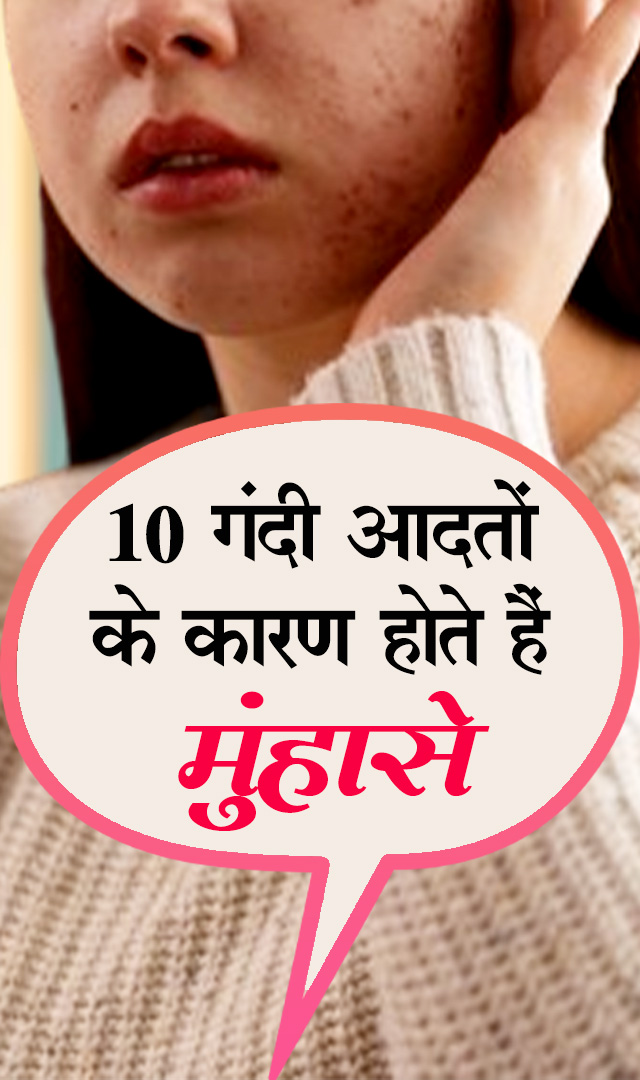 10 गंदी आदतों के कारण होते हैं मुंहासे
