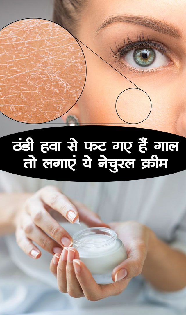 ठंडी हवा से फट गए हैं गाल तो लगाएं ये नेचुरल क्रीम