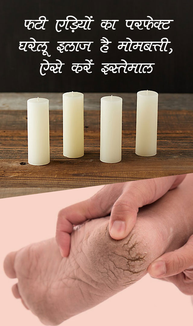 फटी एड़ियों का परफेक्ट घरेलू इलाज है मोमबत्ती, ऐसे करें इस्तेमाल