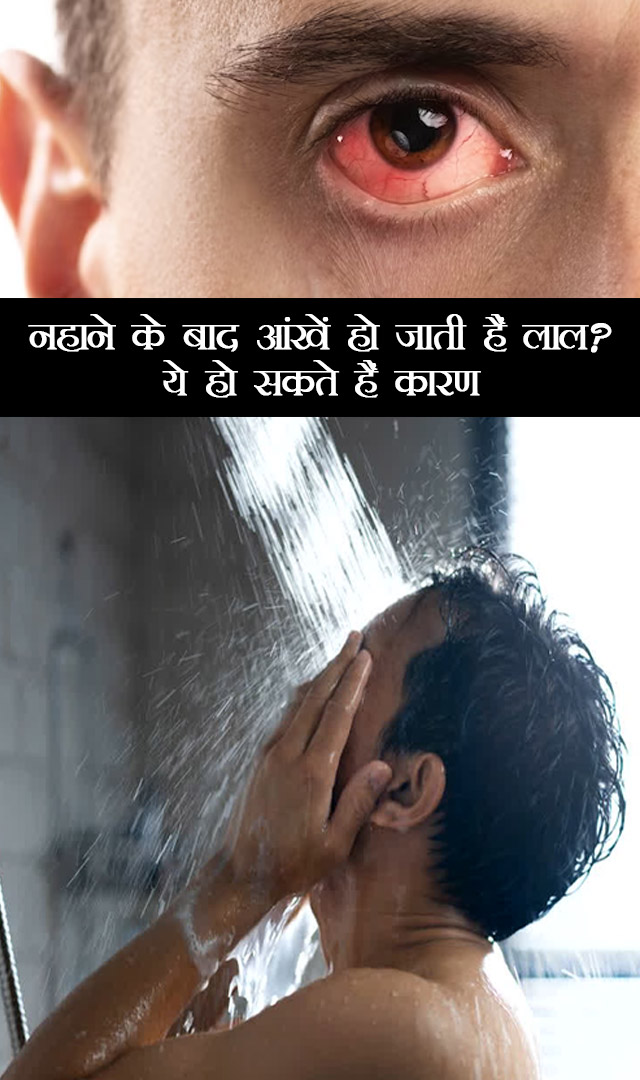 नहाने के बाद आंखें हो जाती हैं लाल? ये हो सकते हैं कारण