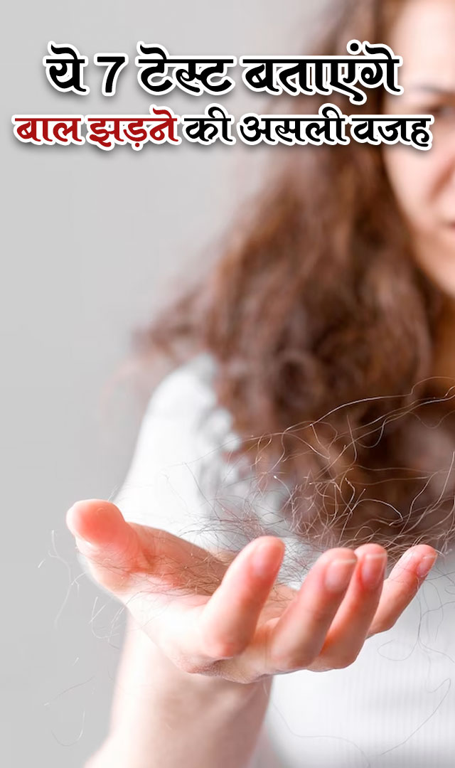 ये 7 टेस्ट बताएंगे बाल झड़ने की असली वजह