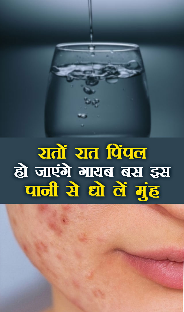 रातों रात पिंपल हो जाएंगे गायब बस इस पानी से धो लें मुंह