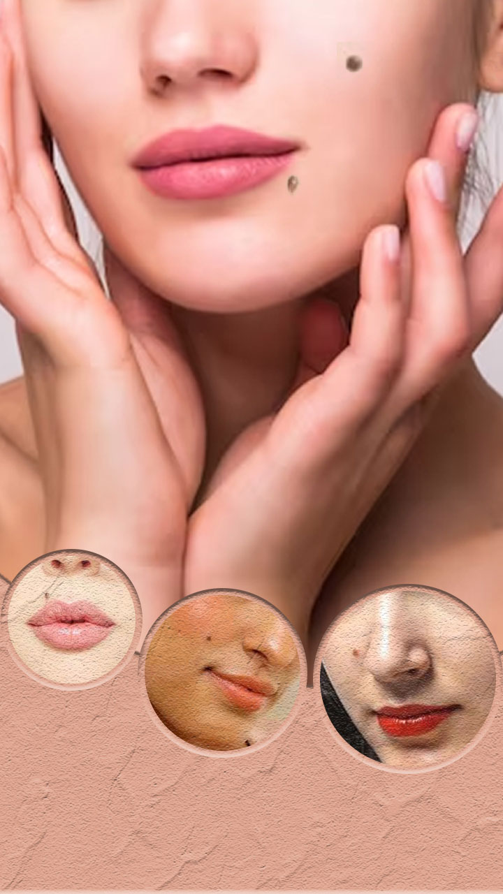 चेहरे के इन 10 हिस्सों पर तिल का मतलब जानें