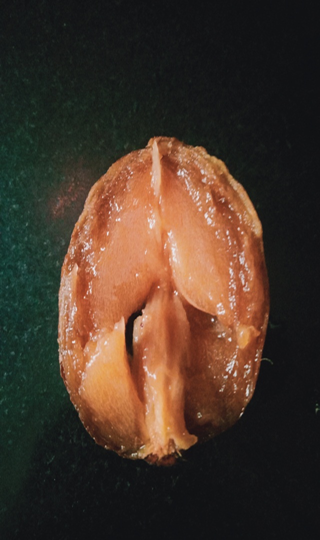 ಪುರುಷರು ಸಪೋಟಾ ತಿಂದರೆ ಏನಾಗುತ್ತದೆ?