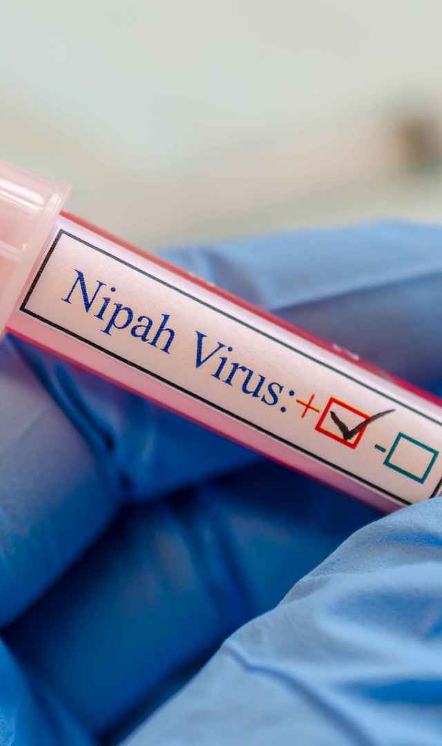 ನಿಫಾ ವೈರಸ್ ಲಕ್ಷಣಗಳು, ತೆಗೆದುಕೊಳ್ಳಬೇಕಾದ ಮುನ್ನೆಚ್ಚರಿಕೆಗಳೇನು?