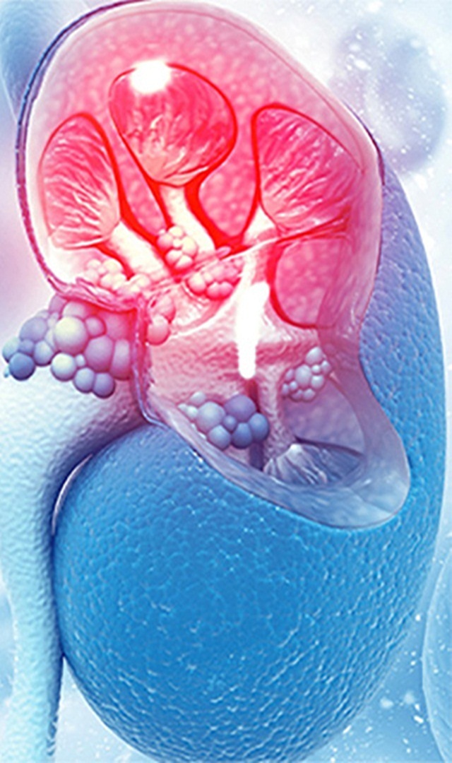 ಮೂತ್ರಪಿಂಡದ ಕಾಯಿಲೆ ಇರುವವರು ತೆಂಗಿನ ನೀರನ್ನು ಕುಡಿಯಬಹುದೇ?