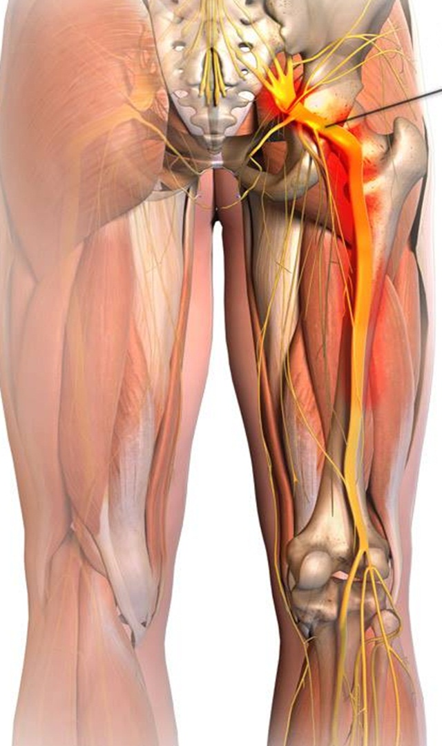 ಕಾಲು ನೋವನ್ನು ಶಮನಗೊಳಿಸಲು 5 ನೈಸರ್ಗಿಕ ಪರಿಹಾರಗಳು