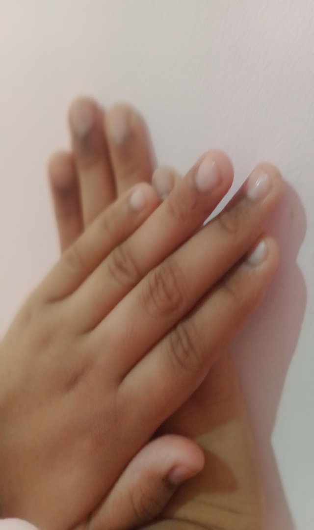 ಕೈ ನಡುಗಲು ಕಾರಣಗಳೇನು