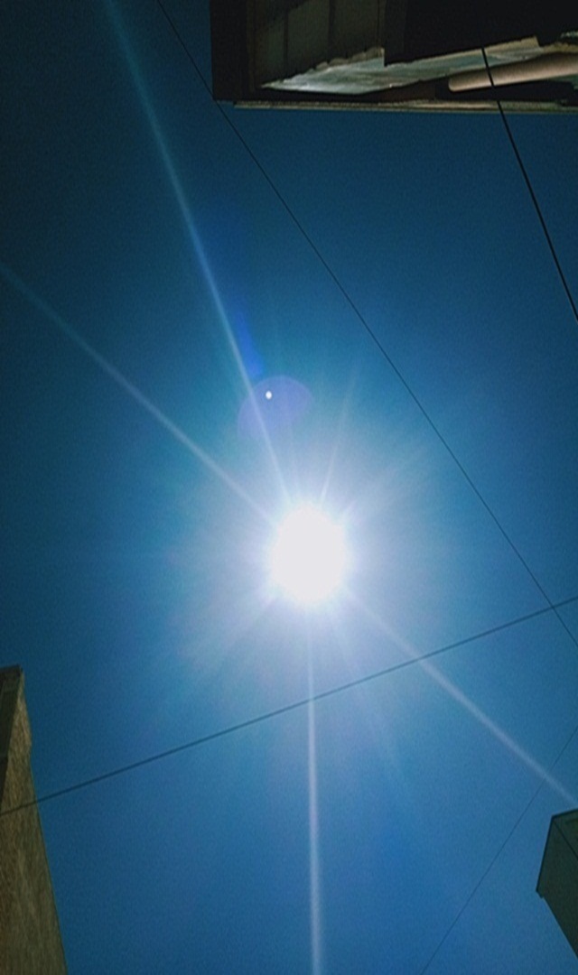 ಬಿಸಿಲಿನ ಬೇಗೆ ತಣಿಸಲು ಐದು ಉಪಾಯಗಳು