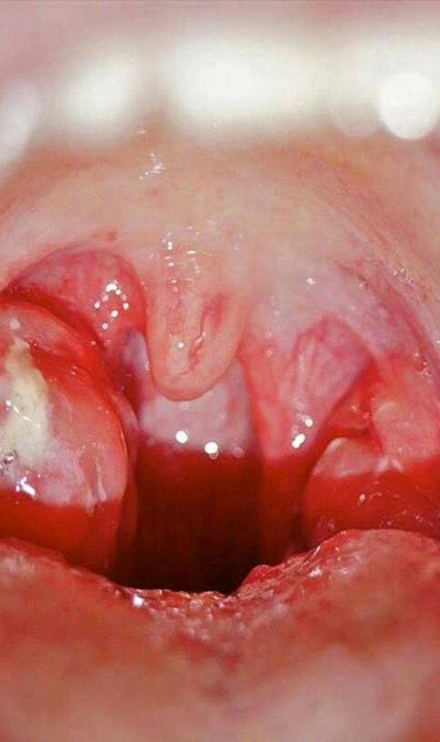 ಬಾಯಿ ಕೆಟ್ಟ ವಾಸನೆ ಬರುತ್ತಿದ್ದರೆ ಹೀಗೆ ಮಾಡಿ