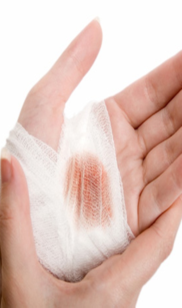 ಮಕ್ಕಳು ಬಿದ್ದು ಗಾಯ ಮಾಡಿಕೊಂಡರೆ ಮನೆಮದ್ದು