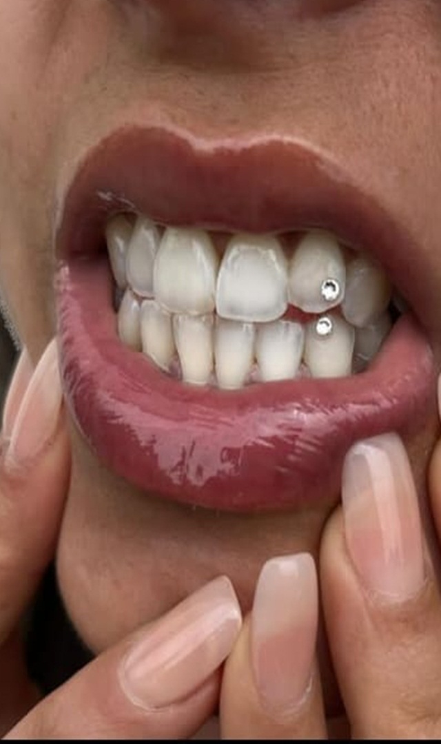 ಬೇರೆಯವರು ಜಗಿಯುವ ಶಬ್ಧಕ್ಕೆ ಕಿರಿಕಿರಿಯಾಗುವುದೇಕೆ