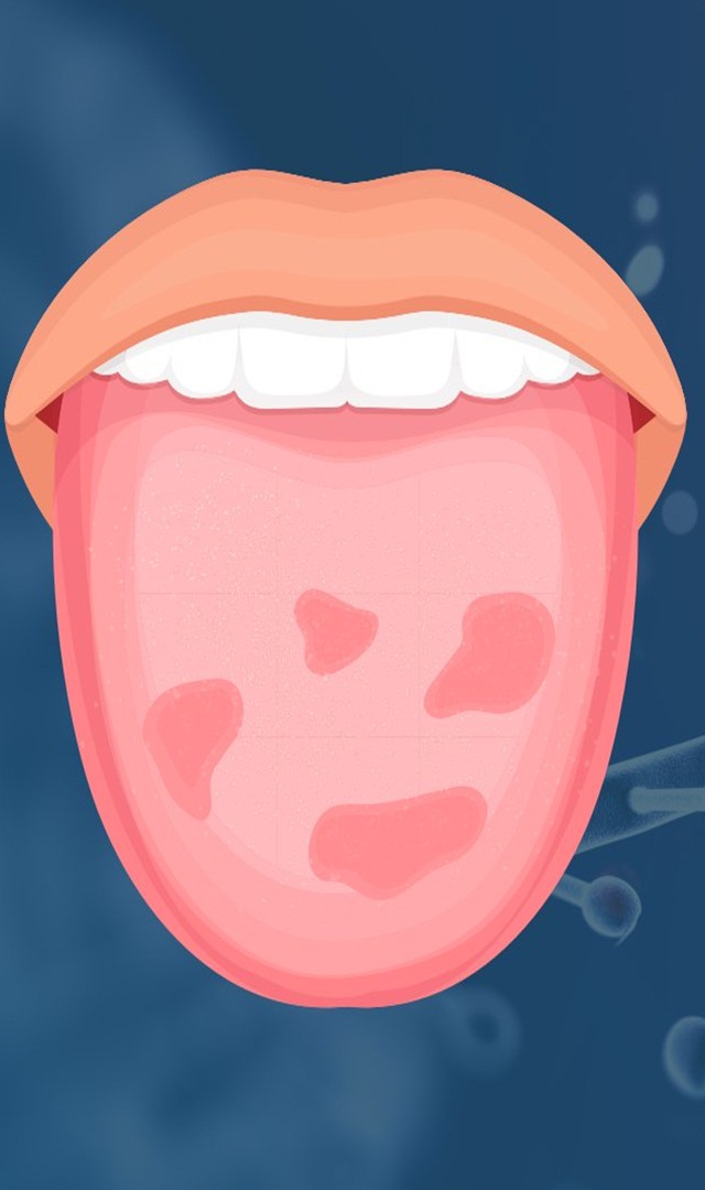 ನಾಲಿಗೆ ಒಣಗಿ ಬರುವುದು ಸಹಜವಲ್ಲ