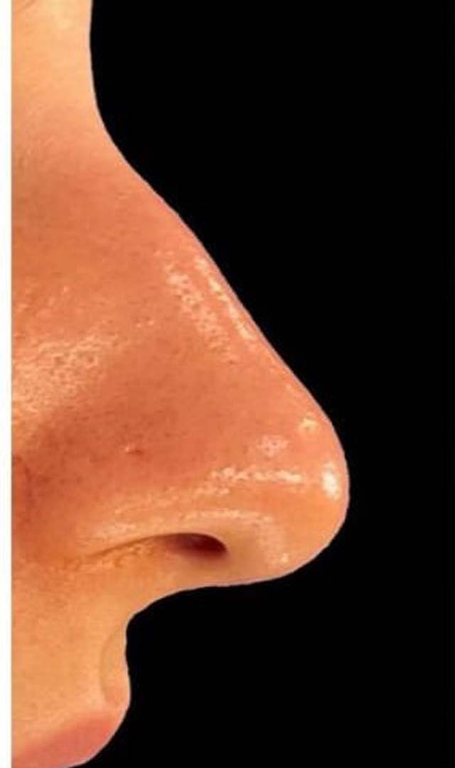 ಕಟ್ಟಿದ ಮೂಗು ತೆರೆಯಲು ಮನೆ ಮದ್ದು ಮಾಡಿ