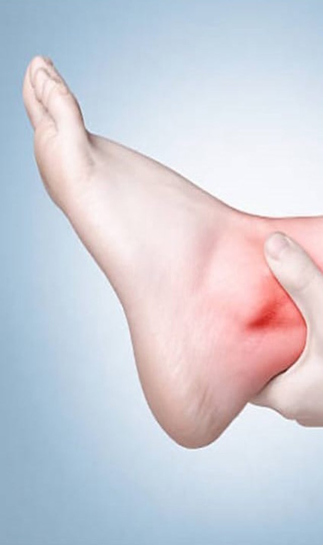 ಕಾಲು ಉಳುಕಿದರೆ ಏನು ಮಾಡಬೇಕು
