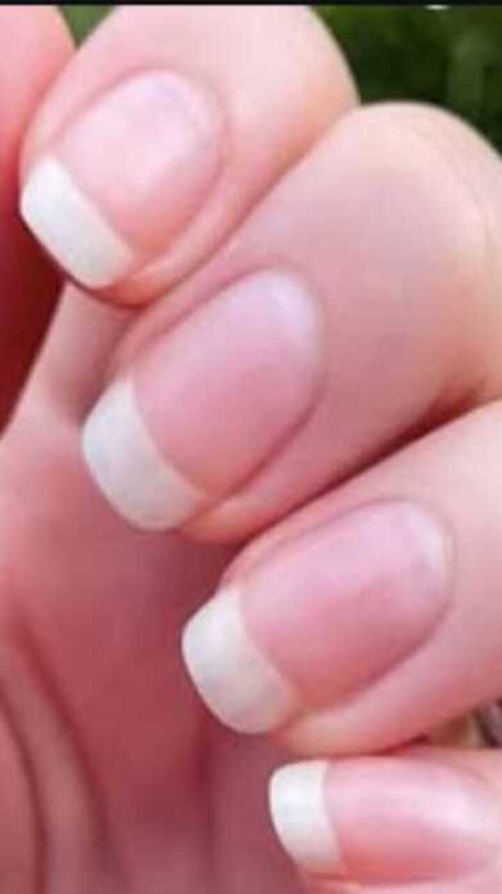 ಉಗುರು ಬೆಳೆಸಲು ಈ ಟಿಪ್ಸ್ ಬೆಸ್ಟ್