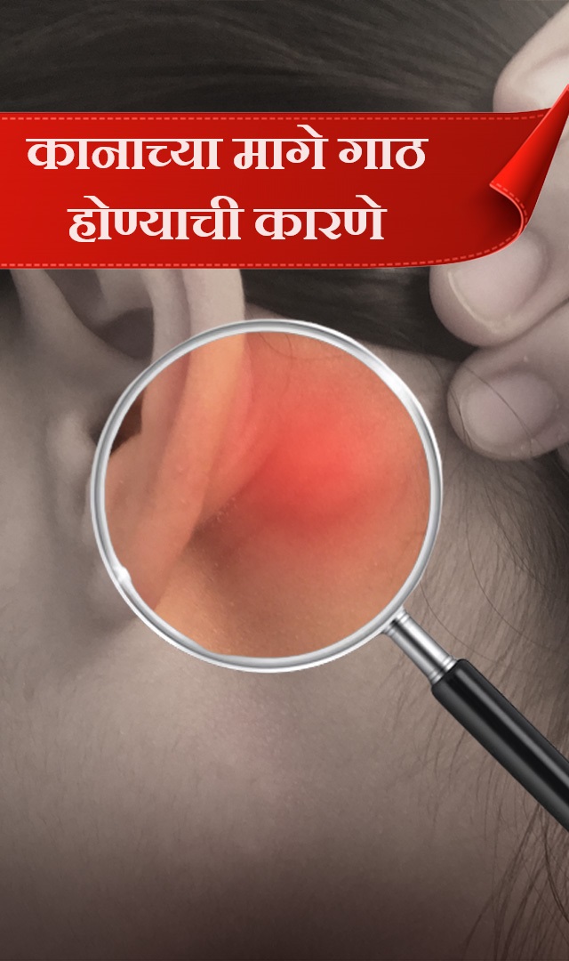 कानाच्या मागे गाठ होण्याची कारणे 