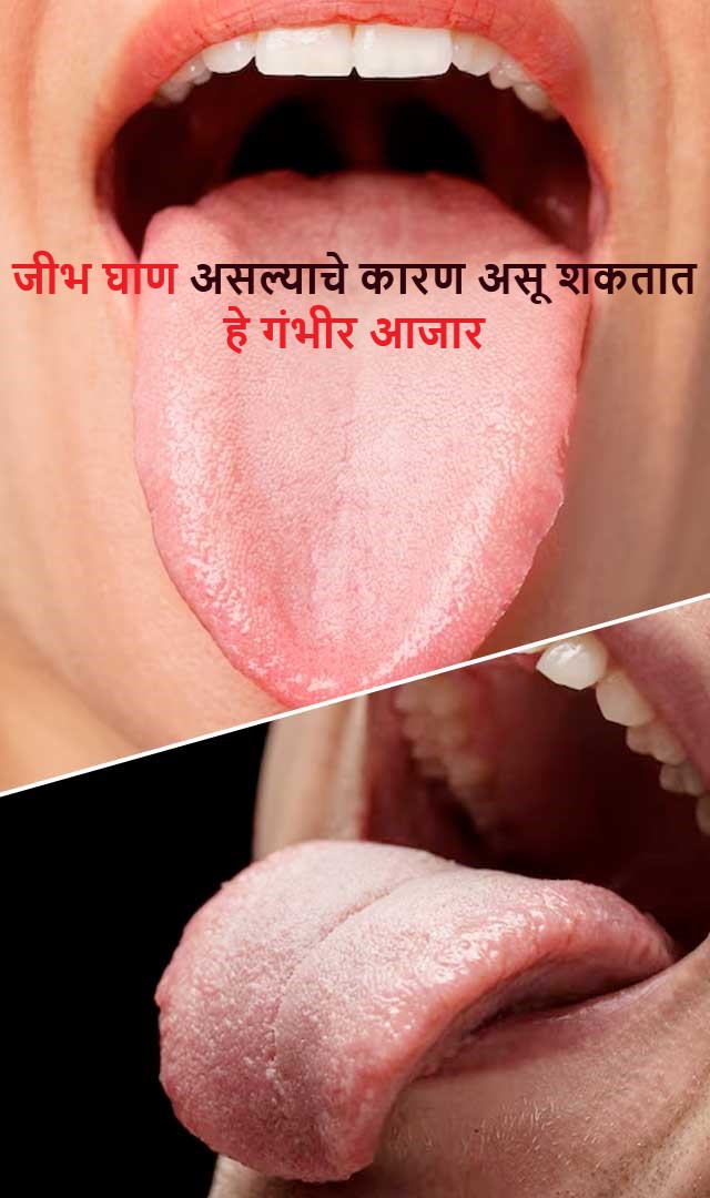 हे गंभीर आजार जीभ घाण असल्याचे कारण असू शकतात