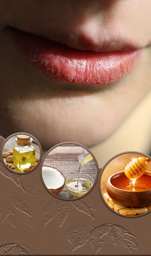 फाटलेल्या ओठांसाठी 5 घरगुती उपाय