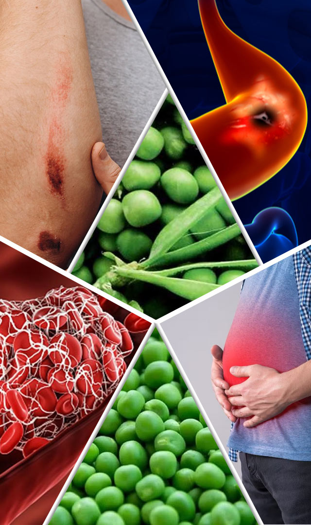 हिरवे वाटाणे खाण्यापूर्वी 7 तोटे जाणून घ्या